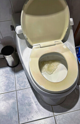 https://blockeddrainssouthperth.com.au/uploads/2025/07/blocked-toilet-27293.jpg
